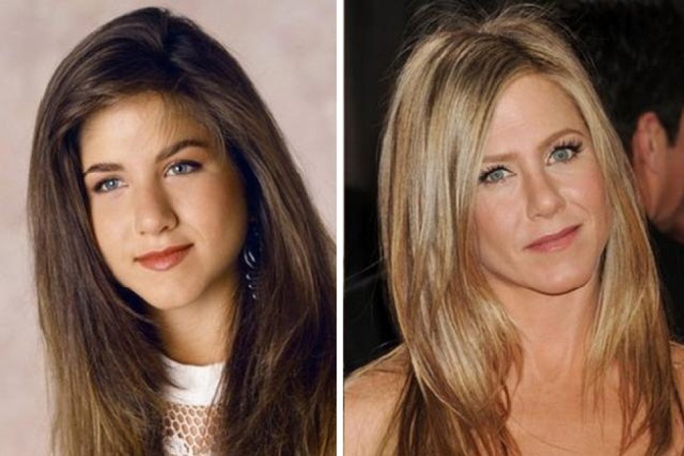 Jennifer Aniston nariz antes y después