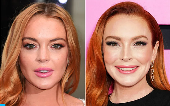 Lindsay Lohan rinoplastia antes y despues