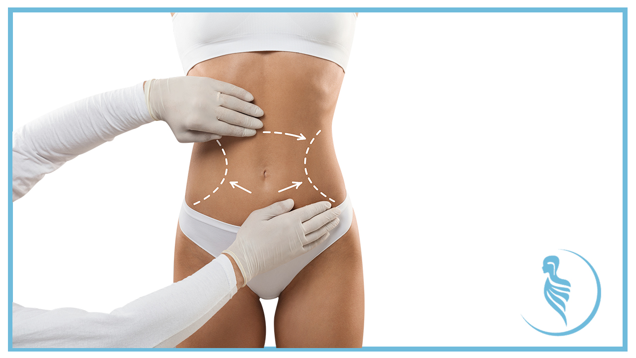 6-cosas-sobre-la-marcacion-abdominal-que-debes-conocer