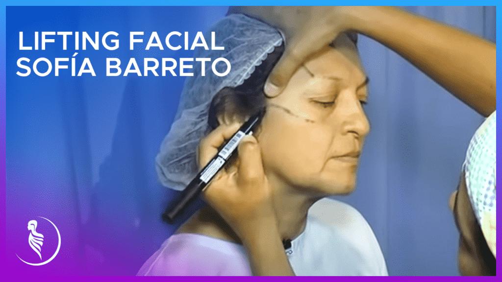 Lifting Facial