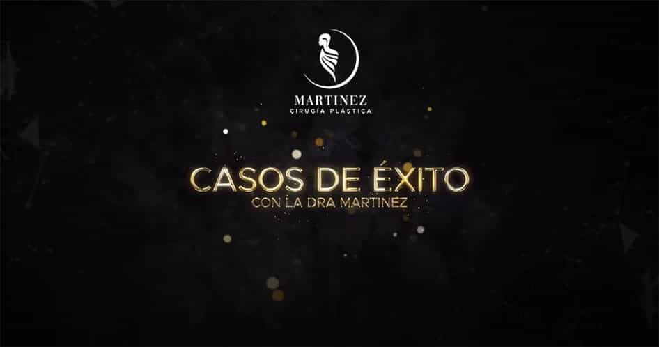 casos