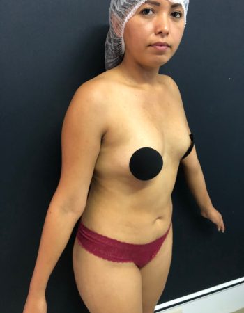 pre2