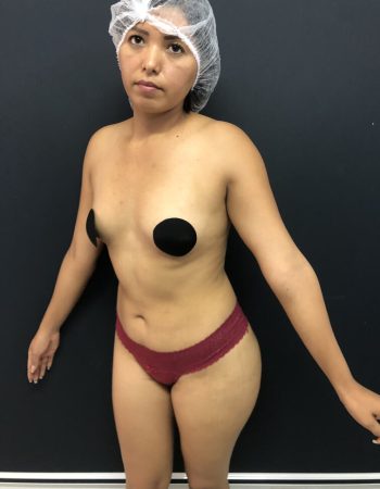 pre3